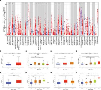 Interferon Regulatory Factor 4 Correlated With Immune Cells Infiltration Could Predict Prognosis for Patients With Lung Adenocarcinoma